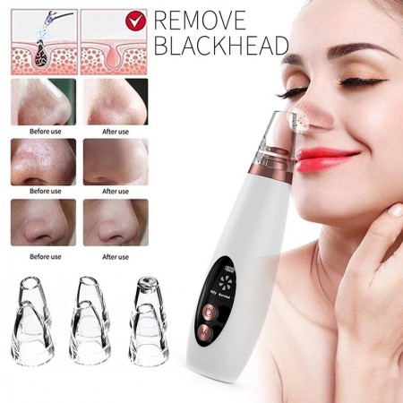 Blackheads Removal Machine.